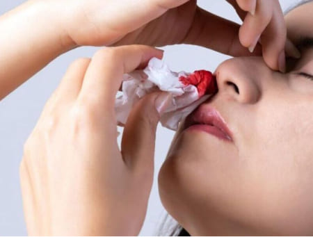 Признаки употребления мефедрона Девушка с окровавленной салфеткой